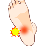 かかとの痛みに悩む女性が靴を履こうとする様子