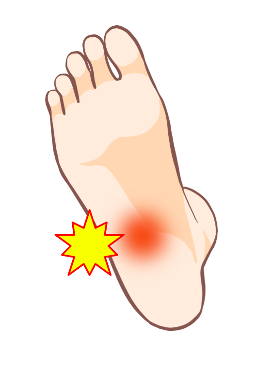 かかとの痛みに悩む女性が靴を履こうとする様子