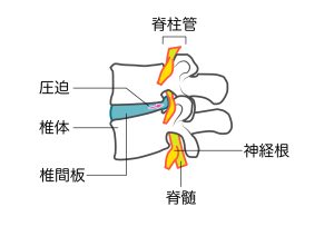 脊柱管と脊髄神経の構造を示すイラスト