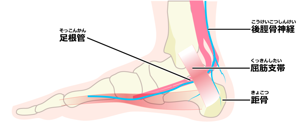 内くるぶし付近を通る神経と足根管のイラスト