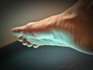 偏平足の足裏の例を見せる子どもと大人の足