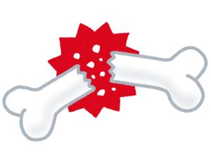 骨折から骨の再生までのイラスト